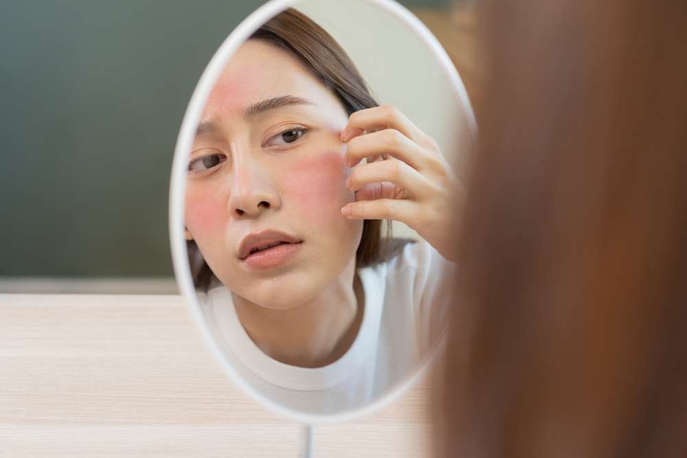 Acne Rosacea behandelen met duurzame huidverzorging van Leef.nl